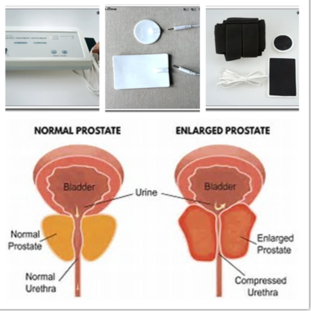Potente Massaggiatore Prostati - Therapy Health And Wellness recensione e prezzo